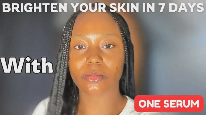 Achieve Radiant Skin: Best Serums for Hyperpigmentation