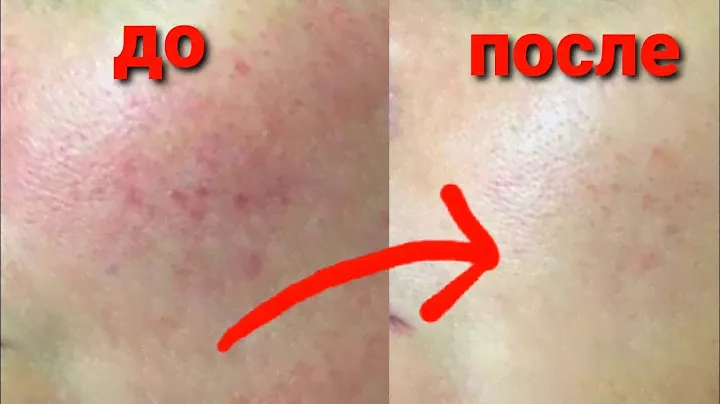 By Wishtrend PURE VITAMIN C 21.5% ADVANCED SERUM Отзывы | Лучшая сыворотка для лица с витамином С
